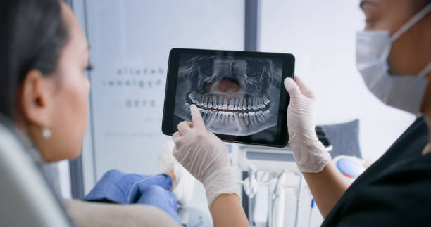 Licensed Dental Implants service in Pacific Grove, CA - Smile Center Dentistry
